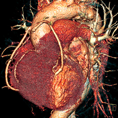 scan of a heart heart image
