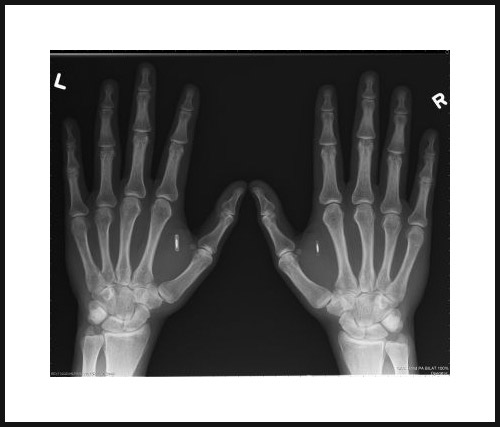 RFID Hand